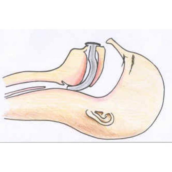 tubo de guedel para abrir las vías en casos de emergencias respiratorias - Modelo